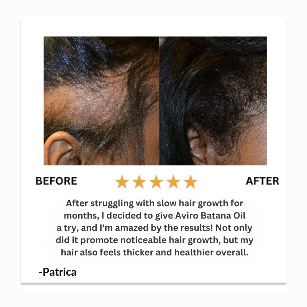 Aviro™ Batana Natural Hair Oil