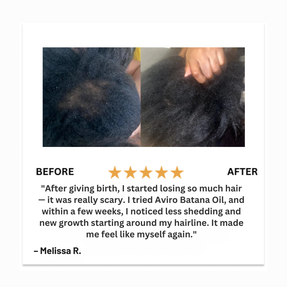 Aviro™ Batana Natural Hair Oil