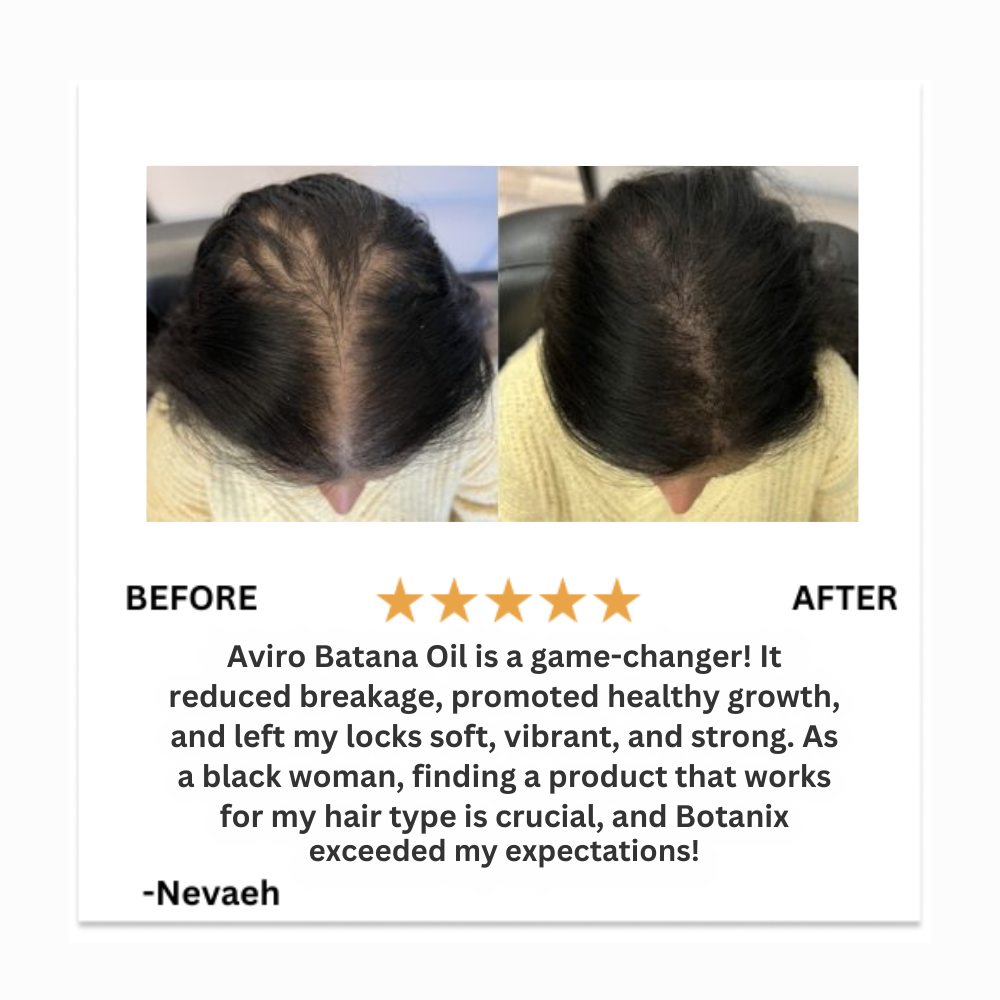 Aviro™ Batana Natural Hair Oil