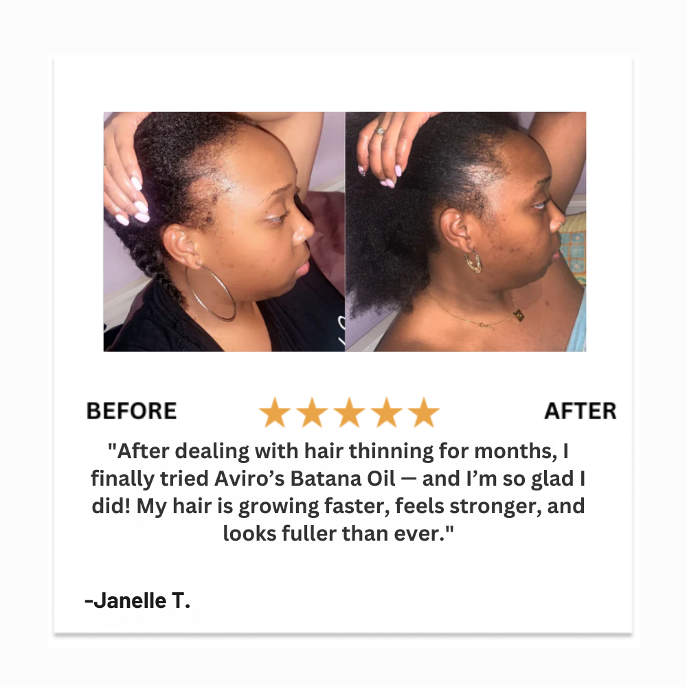 Aviro™ Batana Natural Hair Oil